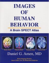 Images of Human Behavior: A Brain SPECT Atlas